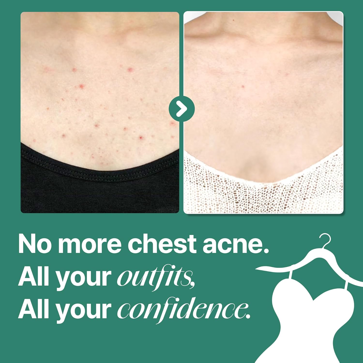 AHA-BHA-PHA 30 Days Miracle Acne Body Cleanser 400g