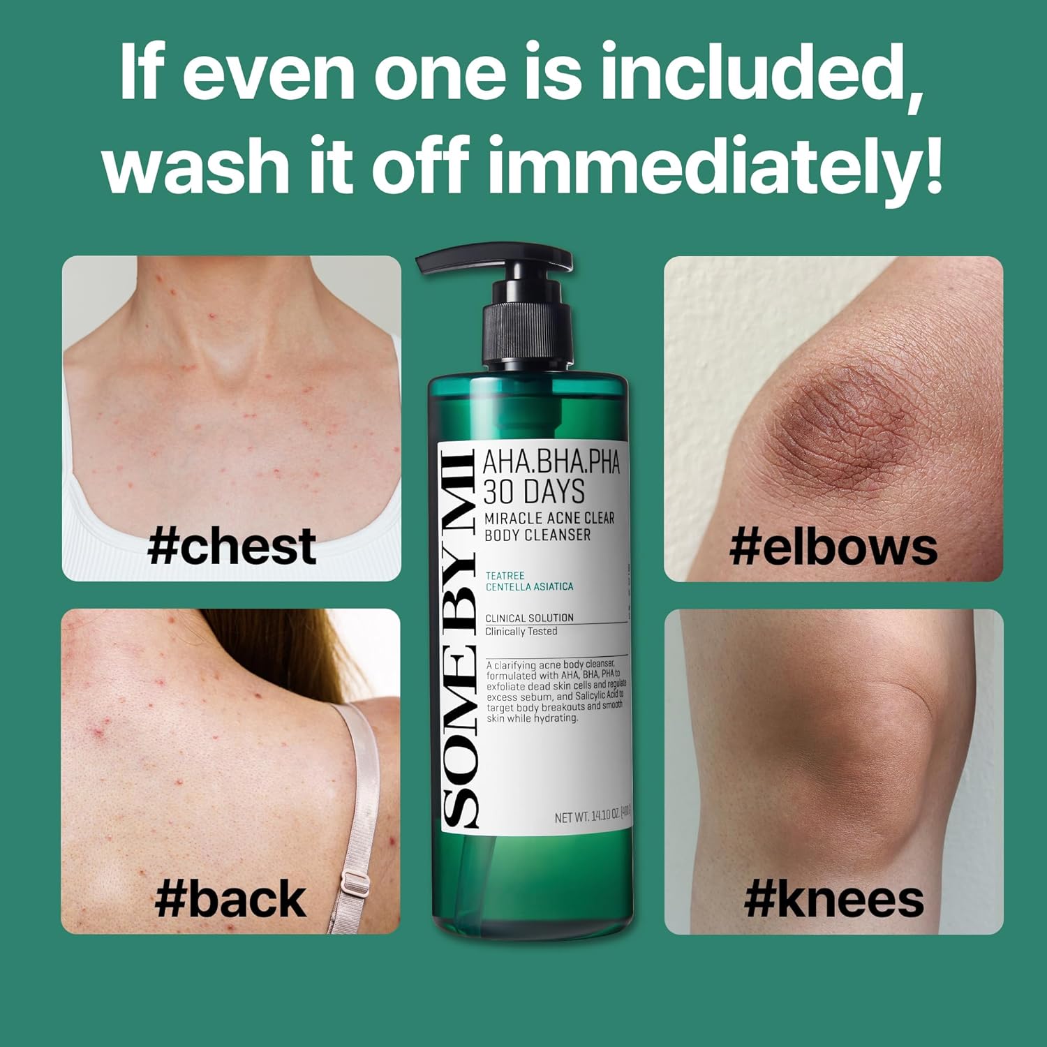 AHA-BHA-PHA 30 Days Miracle Acne Body Cleanser 400g