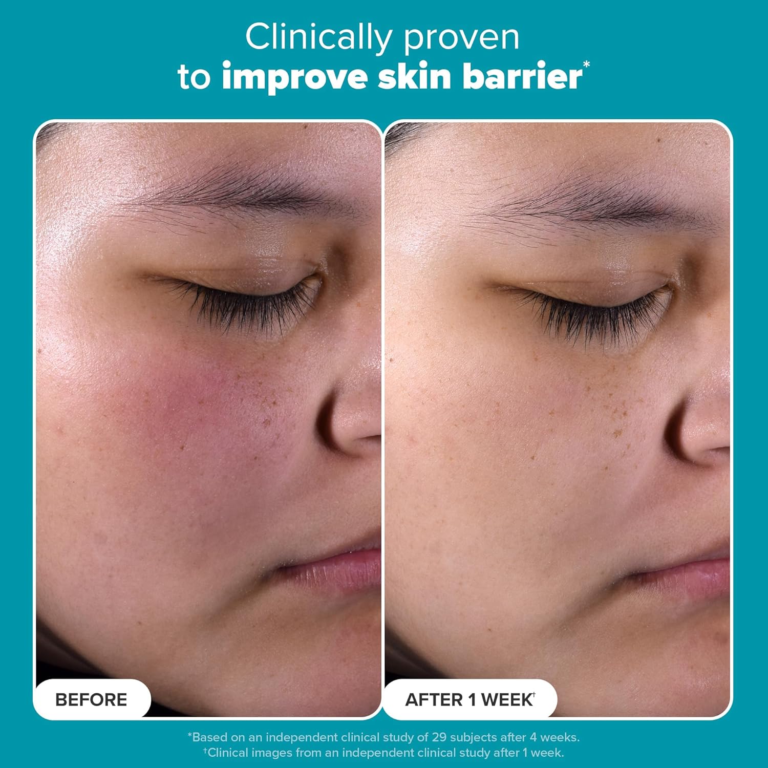 Exfoliate 2% BHA Liquid Exfoliant 118ml