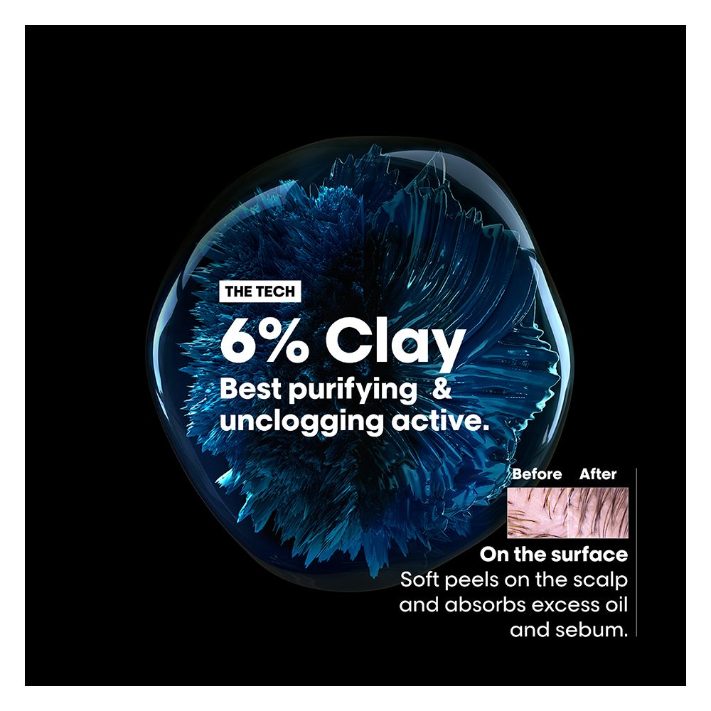 L'Oreal Professionnel Serie Expert Scalp Advanced Shampoo 300 ML - For Oily Scalp With AHA Formula